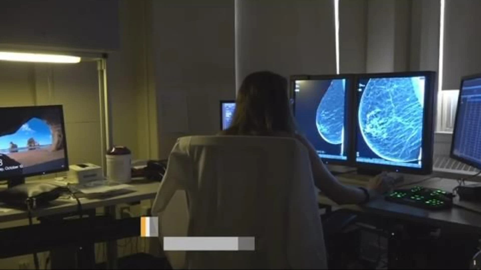 New innovations in breast cancer brings 3D mammograms