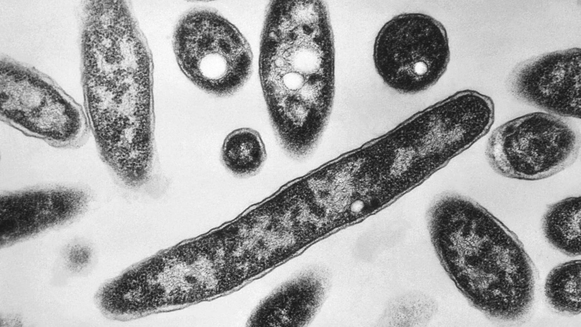 NYC Health Department: No new Legionnaires’ disease cases identified following Highbridge cluster 