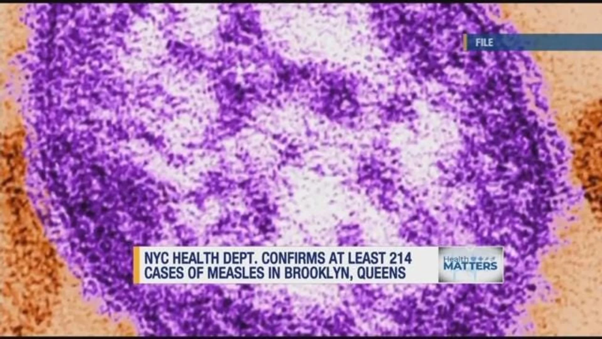 NYC DOH: At least 214 cases of measles in Brooklyn, Queens