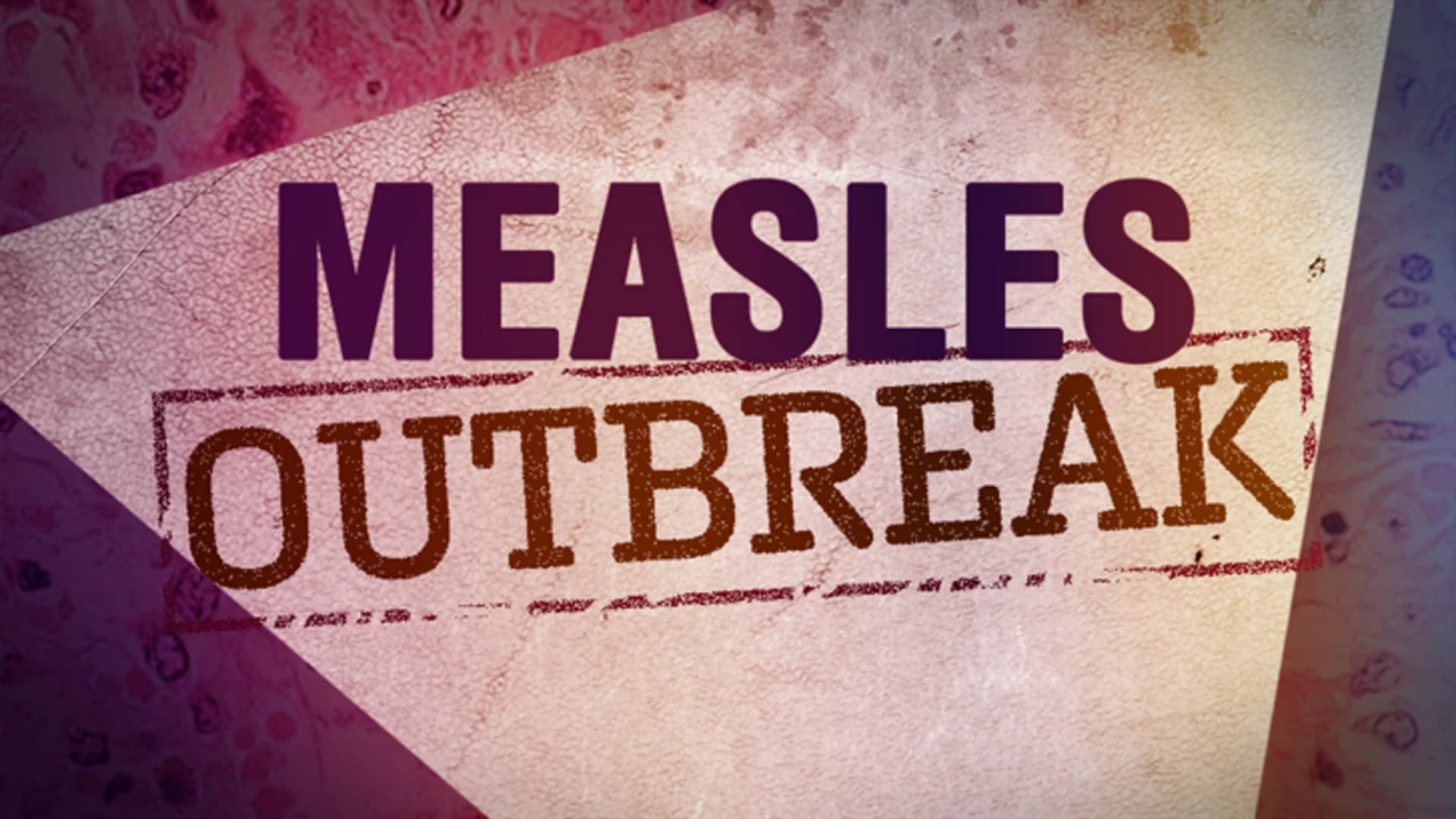 Measles Resources